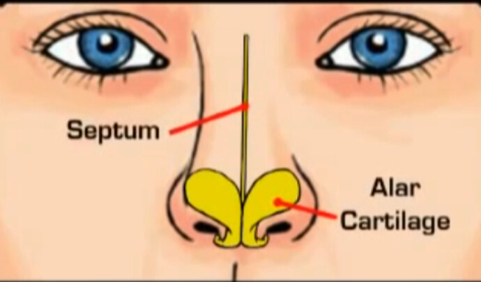 鼻部解剖 鼻整形手术方式及对比案例