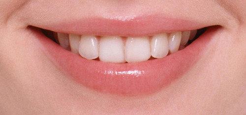 牙齿漂白的副作用有哪些