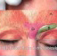 肉毒杆菌注射祛除眉间纹