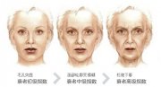 皮肤衰老的主要表现